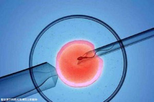 严重少弱精